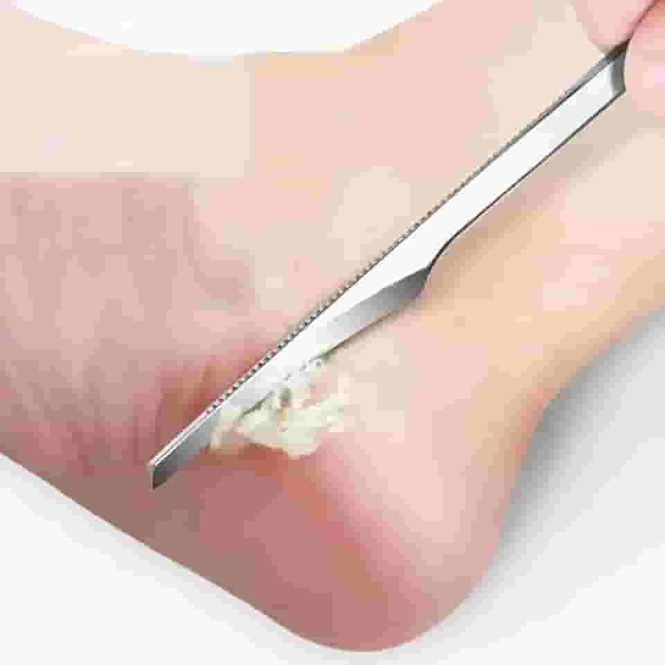 Kit profissional de pedicure – Pacote com 3 lixas para pés e removedores de calos de aço inoxidável – Raspador de pele morta para homens e mulheres – Ferramentas duráveis de cuidados com os pés para