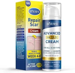 Creme para cicatrizes, gel ativo de silicone dimeticona para cicatrizes antigas para cicatrizes cirúrgicas, estrias, queimaduras, queloides, tratamento para acne (50 g)