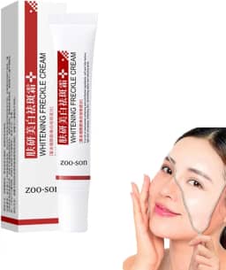 Creme clareador de sardas, creme de tratamento para remoção de cicatrizes de acne, creme de clareamento eficaz de sardas, creme corretor de manchas escuras remove creme de masma, creme
